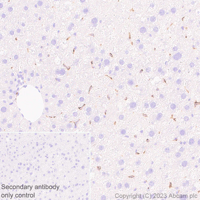 Immunohistochemistry (Formalin/PFA-fixed paraffin-embedded sections) - Anti-Cathepsin S antibody [EPR26156-57] (AB309090)