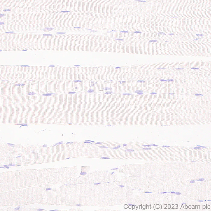 Immunohistochemistry (Formalin/PFA-fixed paraffin-embedded sections) - Anti-Cathepsin S antibody [EPR26156-57] (AB309090)