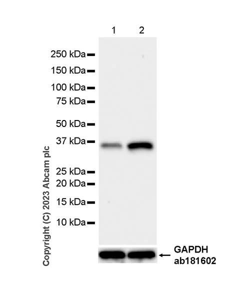 Western blot - Anti-Cathepsin S antibody [EPR26156-57] (AB309090)