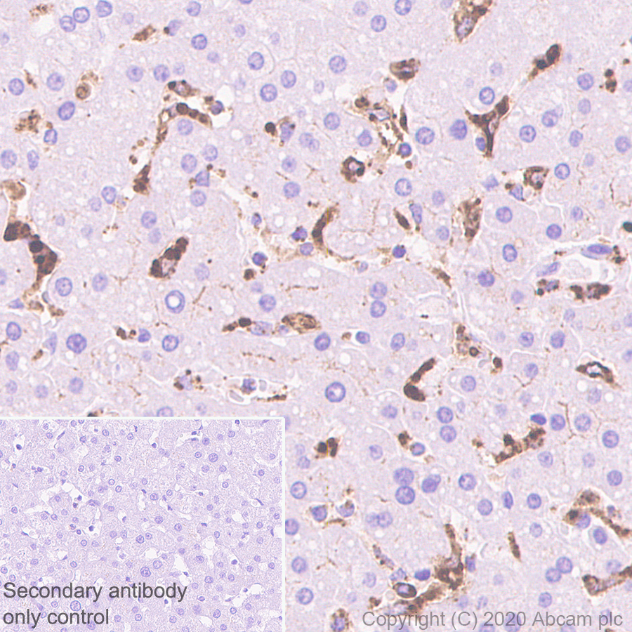 Immunohistochemistry (Formalin/PFA-fixed paraffin-embedded sections) - Anti-Cathepsin S antibody [EPR5128] (AB134157), expandable thumbnail