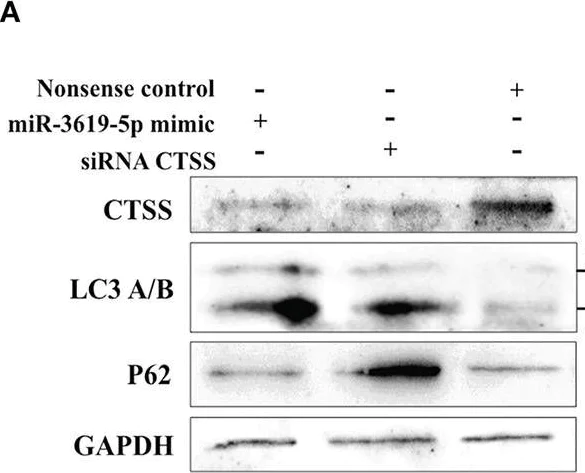Western blot - Anti-Cathepsin S antibody [EPR5128] (AB134157)