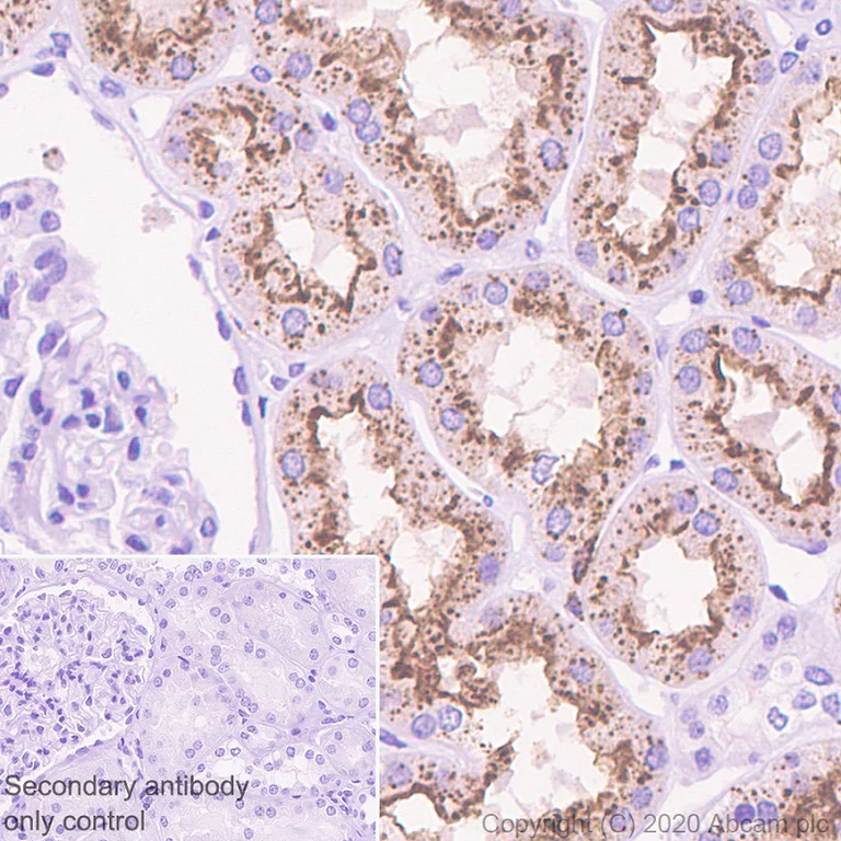 Immunohistochemistry (Formalin/PFA-fixed paraffin-embedded sections) - Anti-Cathepsin S antibody [EPR5128] - BSA and Azide free (AB248706)