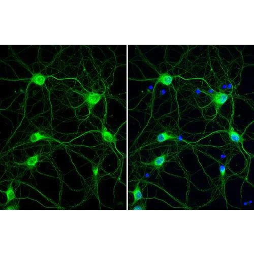Immunocytochemistry/ Immunofluorescence - Anti-Cathepsin S antibody [HL2302] (AB317192)