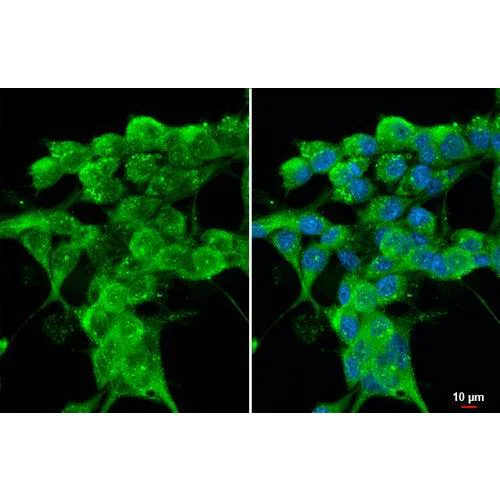 Immunocytochemistry/ Immunofluorescence - Anti-Cathepsin S antibody [HL2302] (AB317192)