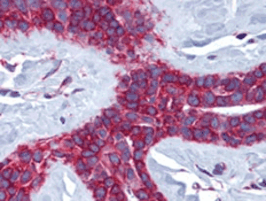 Immunohistochemistry (Formalin/PFA-fixed paraffin-embedded sections) - Anti-Cathepsin V antibody (AB124656)