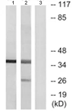 Western blot - Anti-Cathepsin V antibody (AB124656)