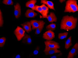 Immunocytochemistry/ Immunofluorescence - Anti-Cathepsin V antibody [EPR10723(B)] - BSA and Azide free (AB249378)