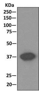 Immunoprecipitation - Anti-Cathepsin V antibody [EPR10723(B)] - BSA and Azide free (AB249378)