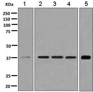 Western blot - Anti-Cathepsin V antibody [EPR10723(B)] - BSA and Azide free (AB249378)