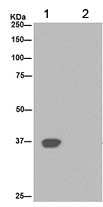 Immunoprecipitation - Anti-Cathepsin W antibody [EPR15135] (AB191083), expandable thumbnail