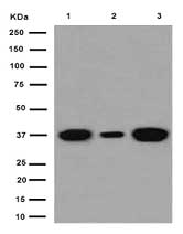 Western blot - Anti-Cathepsin W antibody [EPR15135] (AB191083), expandable thumbnail