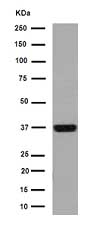 Western blot - Anti-Cathepsin W antibody [EPR15135] (AB191083), expandable thumbnail