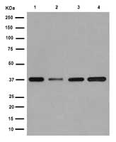 Western blot - Anti-Cathepsin W antibody [EPR15135] (AB191083), expandable thumbnail