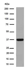 Western blot - Anti-Cathepsin W antibody [EPR15135] - BSA and Azide free (AB251056)