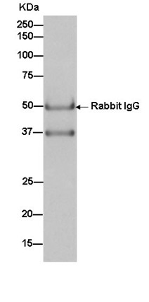 Anti-Cathepsin Z antibody [EPR14357-7]