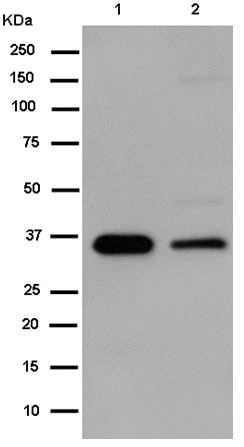 Western blot - Anti-Cathepsin Z antibody [EPR14357-7] (AB182575)