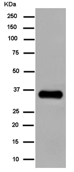 Western blot - Anti-Cathepsin Z antibody [EPR14357-7] (AB182575)