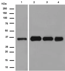 Western blot - Anti-Cathepsin Z antibody [EPR14357] (AB180580)