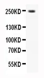 Western blot - Anti-CaV1.3 antibody - C-terminal (AB191038)