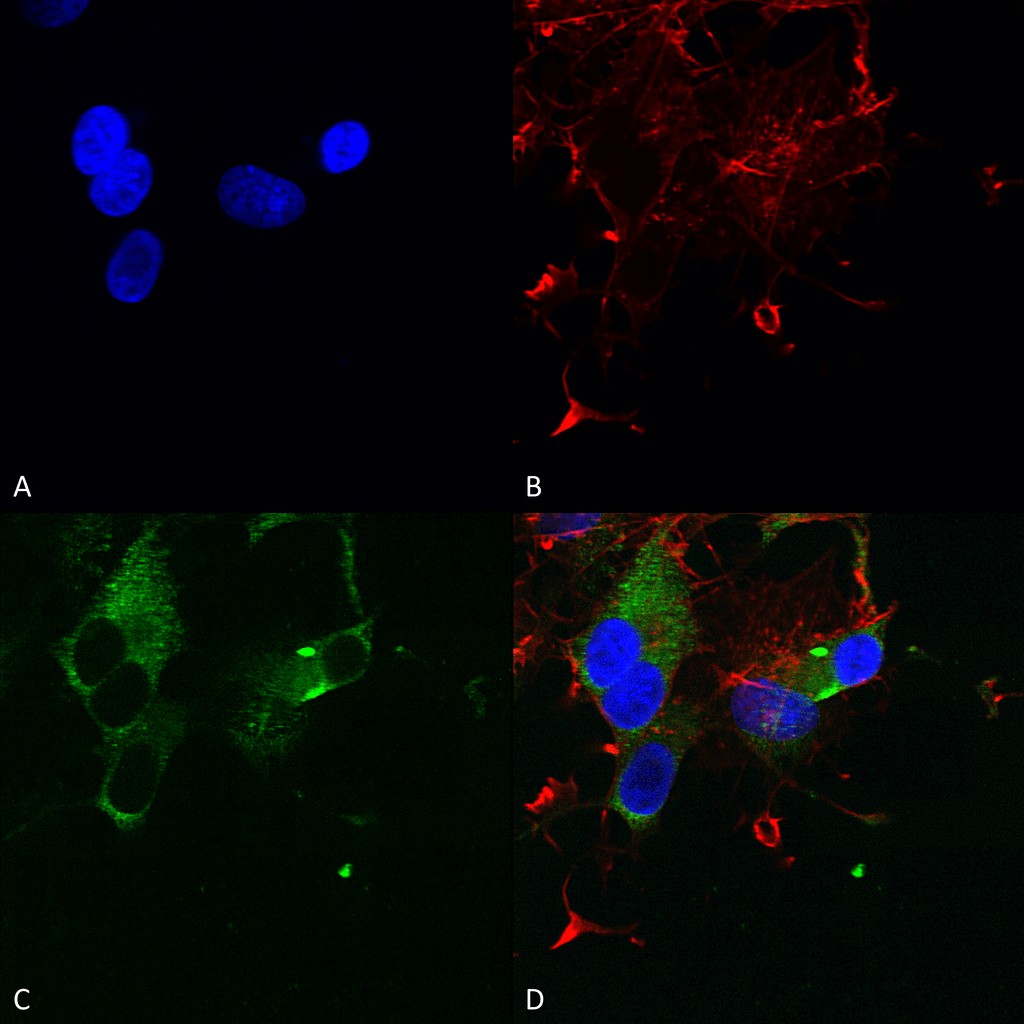 Immunocytochemistry/ Immunofluorescence - Anti-CaV1.3 antibody [S48] (AB85491)