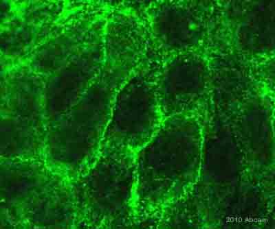 Immunocytochemistry - Anti-Caveolin-1 antibody [7C8] (AB17052), expandable thumbnail