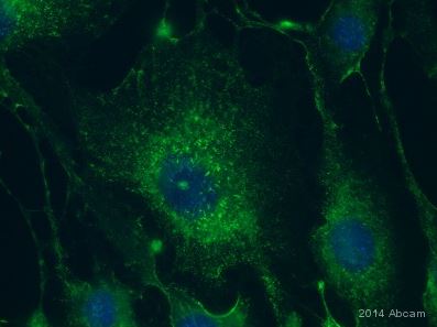 Immunocytochemistry - Anti-Caveolin-1 antibody [7C8] (AB17052), expandable thumbnail