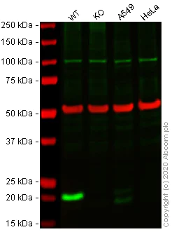 Western blot - Anti-Caveolin-1 antibody [7C8] - Caveolae Marker (AB17052)