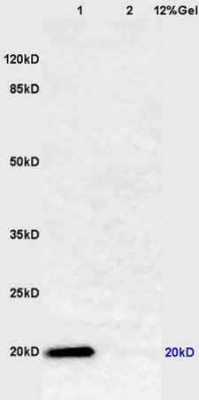 Western blot - Anti-Caveolin-1 antibody (AB214448), expandable thumbnail