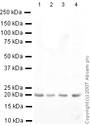 Western blot - Anti-Caveolin-1 antibody - Caveolae Marker (AB18199)