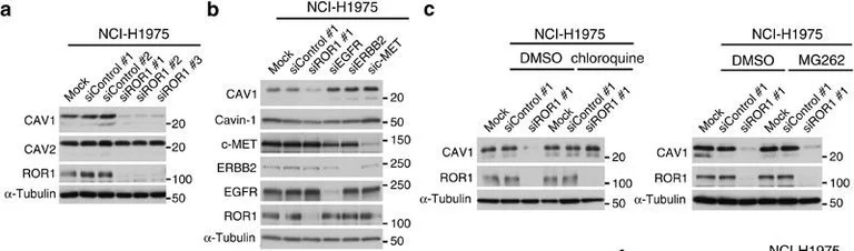 Western blot - Anti-Caveolin-1 antibody - Caveolae Marker (AB18199)