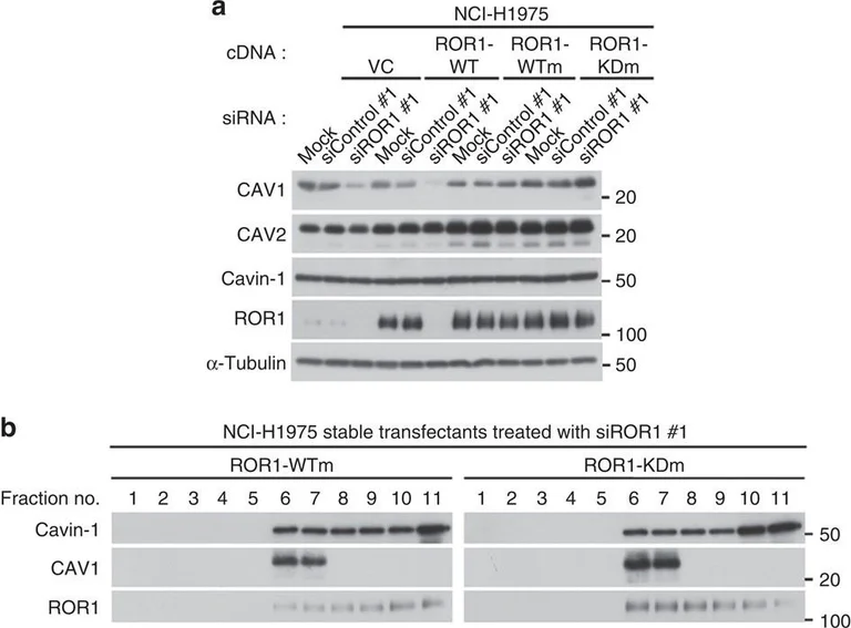 Western blot - Anti-Caveolin-1 antibody - Caveolae Marker (AB18199)