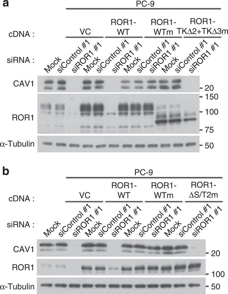 Western blot - Anti-Caveolin-1 antibody - Caveolae Marker (AB18199)