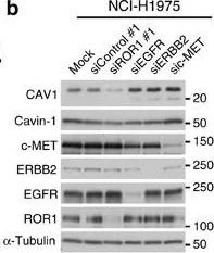 Western blot - Anti-Caveolin-1 antibody - Caveolae Marker (AB18199)