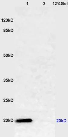 Western blot - Anti-Caveolin-1 antibody - Caveolae Marker (AB214448)