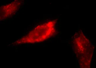 Immunocytochemistry/ Immunofluorescence - Anti-Caveolin-1 antibody - Caveolae Marker (AB2910)