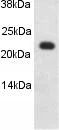Western blot - Anti-Caveolin-1 antibody - Caveolae Marker (AB2910)