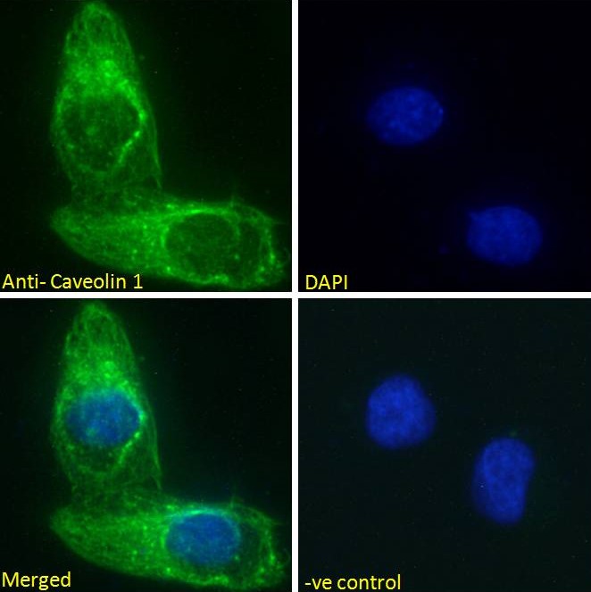 Immunocytochemistry - Anti-Caveolin-1 antibody (AB36152), expandable thumbnail