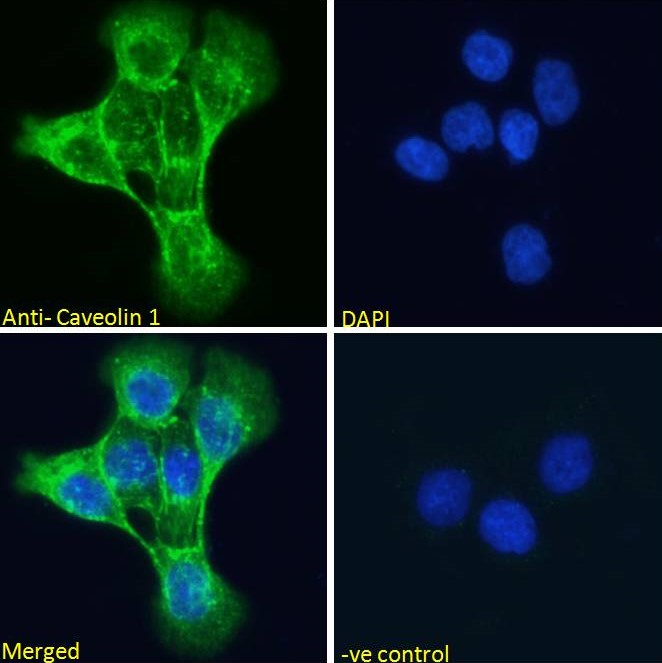 Immunocytochemistry - Anti-Caveolin-1 antibody (AB36152), expandable thumbnail