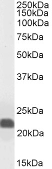 Western blot - Anti-Caveolin-1 antibody - Caveolae Marker (AB36152), expandable thumbnail