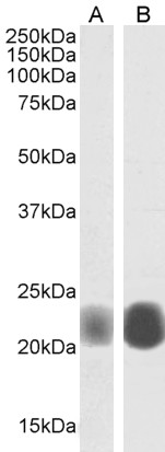 Western blot - Anti-Caveolin-1 antibody - Caveolae Marker (AB36152), expandable thumbnail