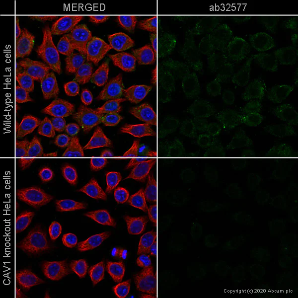 Immunocytochemistry/ Immunofluorescence - Anti-Caveolin-1 antibody [E249] - BSA and Azide free (AB230262)