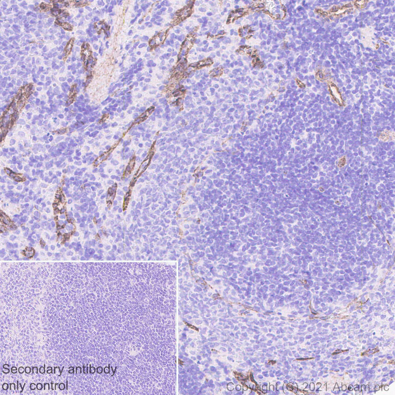 Immunohistochemistry (Formalin/PFA-fixed paraffin-embedded sections) - Anti-Caveolin-1 antibody [E249] - Caveolae Marker (AB32577)