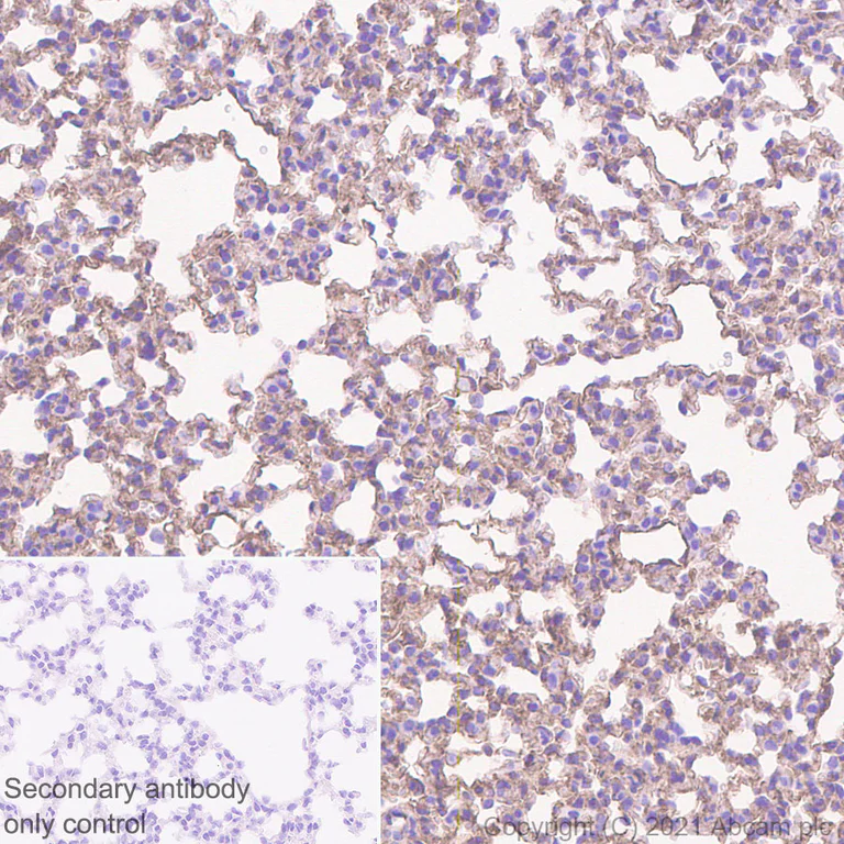 Immunohistochemistry (Formalin/PFA-fixed paraffin-embedded sections) - Anti-Caveolin-1 antibody [E249] - Caveolae Marker (AB32577)