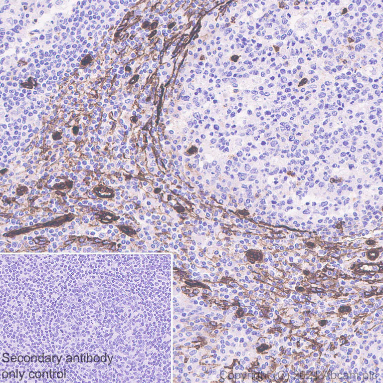 Immunohistochemistry (Formalin/PFA-fixed paraffin-embedded sections) - Anti-Caveolin-1 antibody [E249] - Caveolae Marker (AB32577)