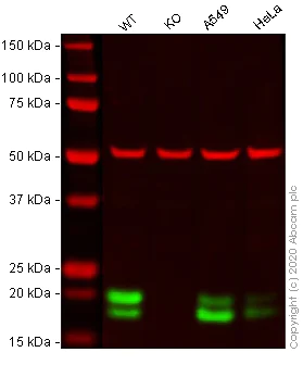 Western blot - Anti-Caveolin-1 antibody [E249] - Caveolae Marker (AB32577)
