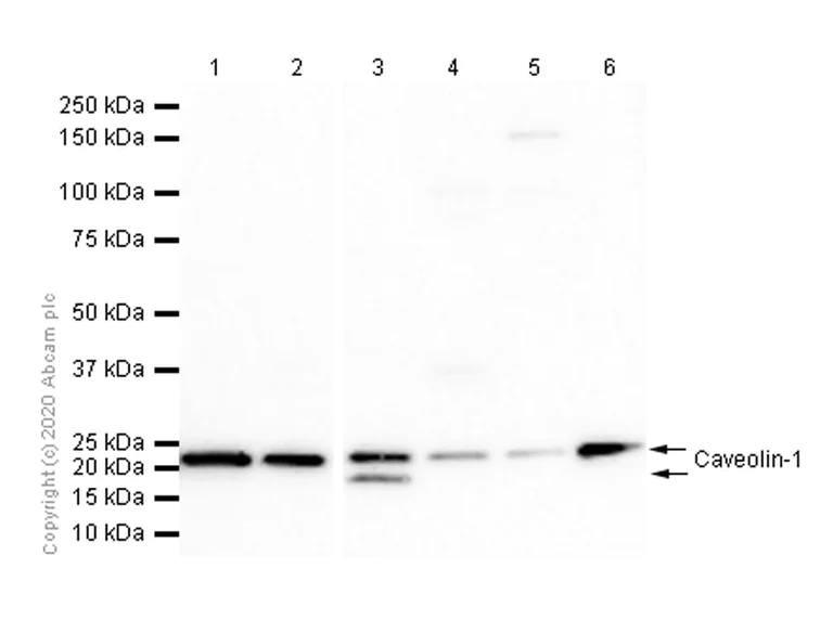 Western blot - Anti-Caveolin-1 antibody [E249] - Caveolae Marker (AB32577)