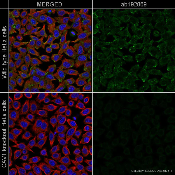 Immunocytochemistry/ Immunofluorescence - Anti-Caveolin-1 antibody [EPR15554] - BSA and Azide free (AB240332)