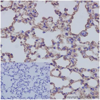 Immunohistochemistry (Formalin/PFA-fixed paraffin-embedded sections) - Anti-Caveolin-1 antibody [EPR15554] - BSA and Azide free (AB240332)