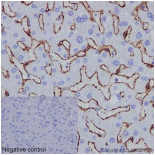 Immunohistochemistry (Formalin/PFA-fixed paraffin-embedded sections) - Anti-Caveolin-1 antibody [EPR15554] - BSA and Azide free (AB240332)