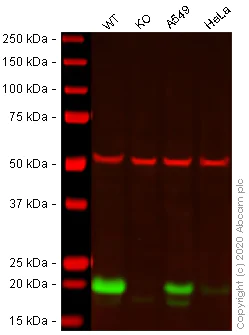 Western blot - Anti-Caveolin-1 antibody [EPR15554] - BSA and Azide free (AB240332)